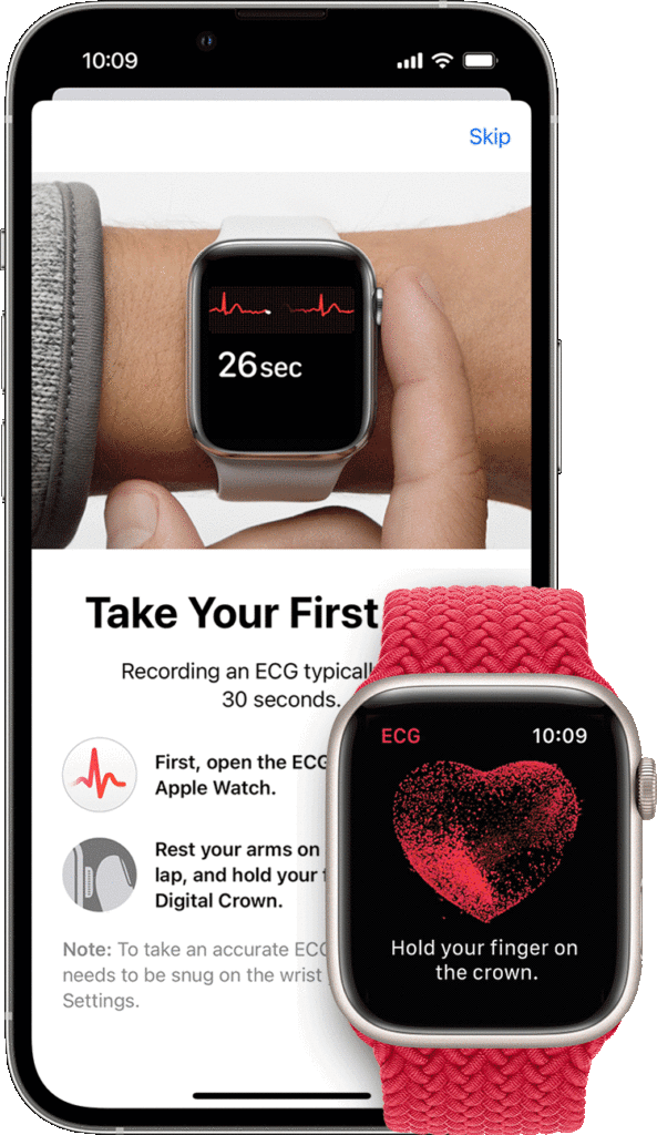 The Australian Heart Watch Study